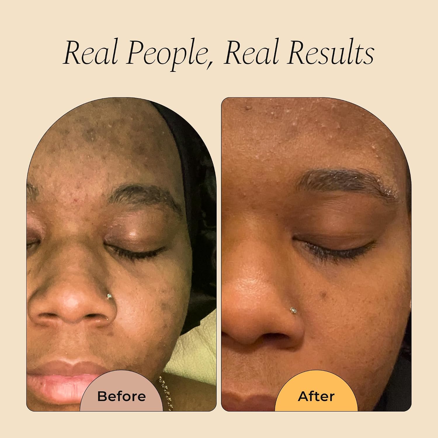 Revitalize Your Skin with Organic Turmeric Soap - The Ultimate Natural Face Wash for Dark Spots and Radiant Complexion